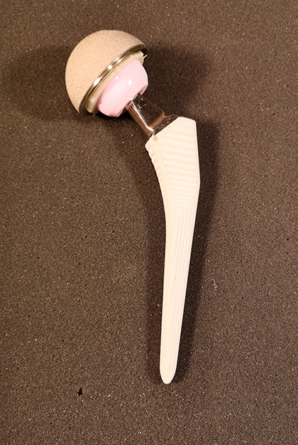 Hüftprothese mit Keramikkopf und Polyethylen-Inlay 