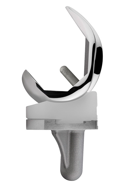 Knieprothese in modernen Medial-Pivot-Design mit Kobalt-Chrom mit Polyethylen-Gleitlager (Ansicht seitlich)