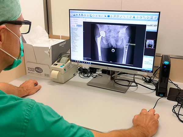 Dr. Hedrich bei der pre-operativen Planung in SuperPath-Technik