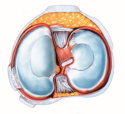 Meniskus Ansicht von oben, links Aussenseite (lateral) – rechts Innenseite (medial)