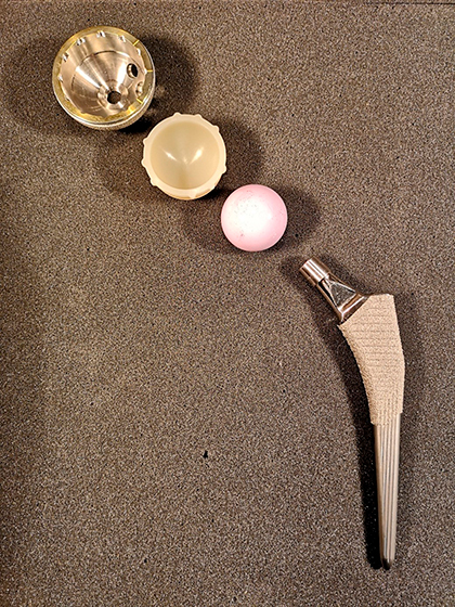  Hüftprothese, zementfreie Hüftpfanne und Hüftschaft